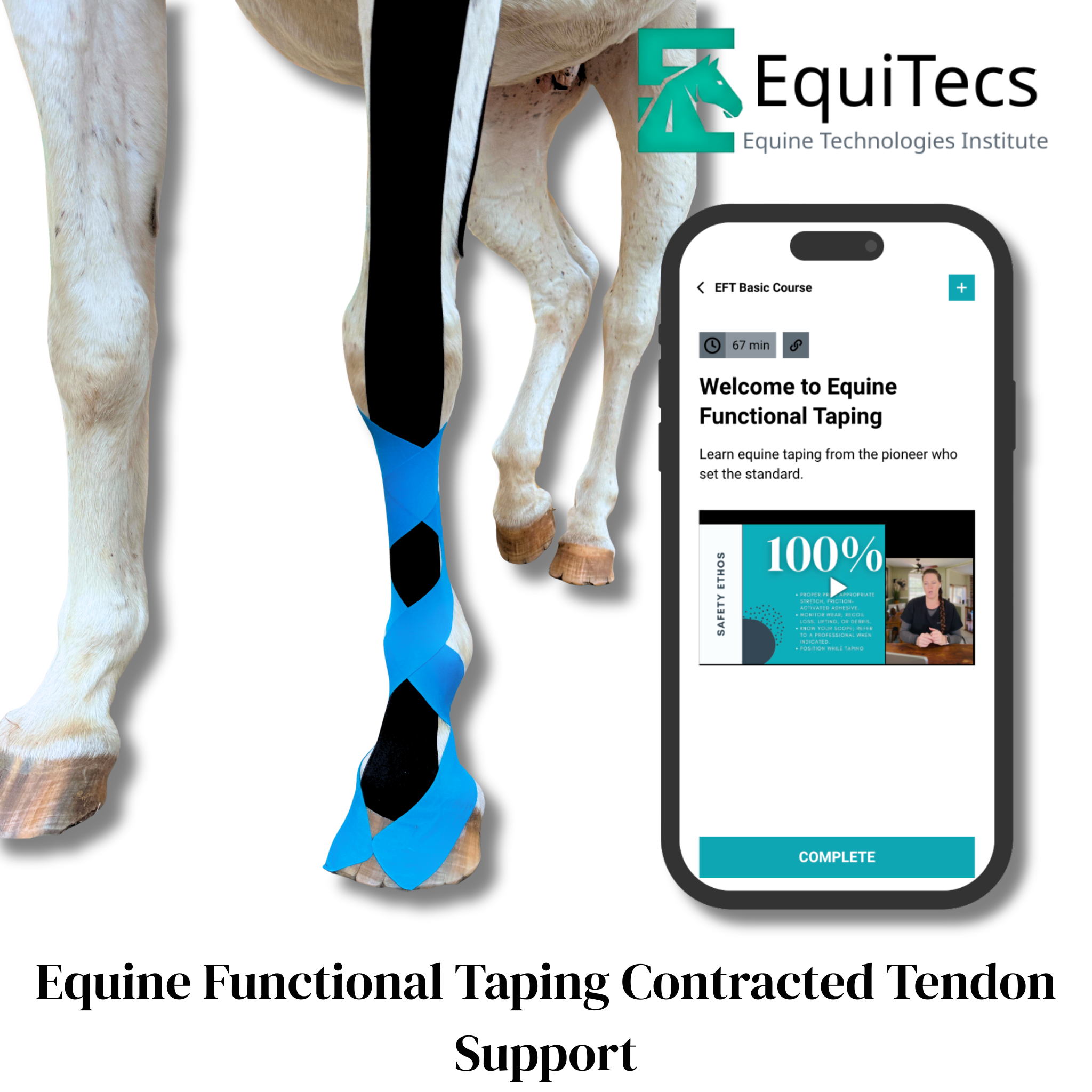 EFT Contracted Tendon Support