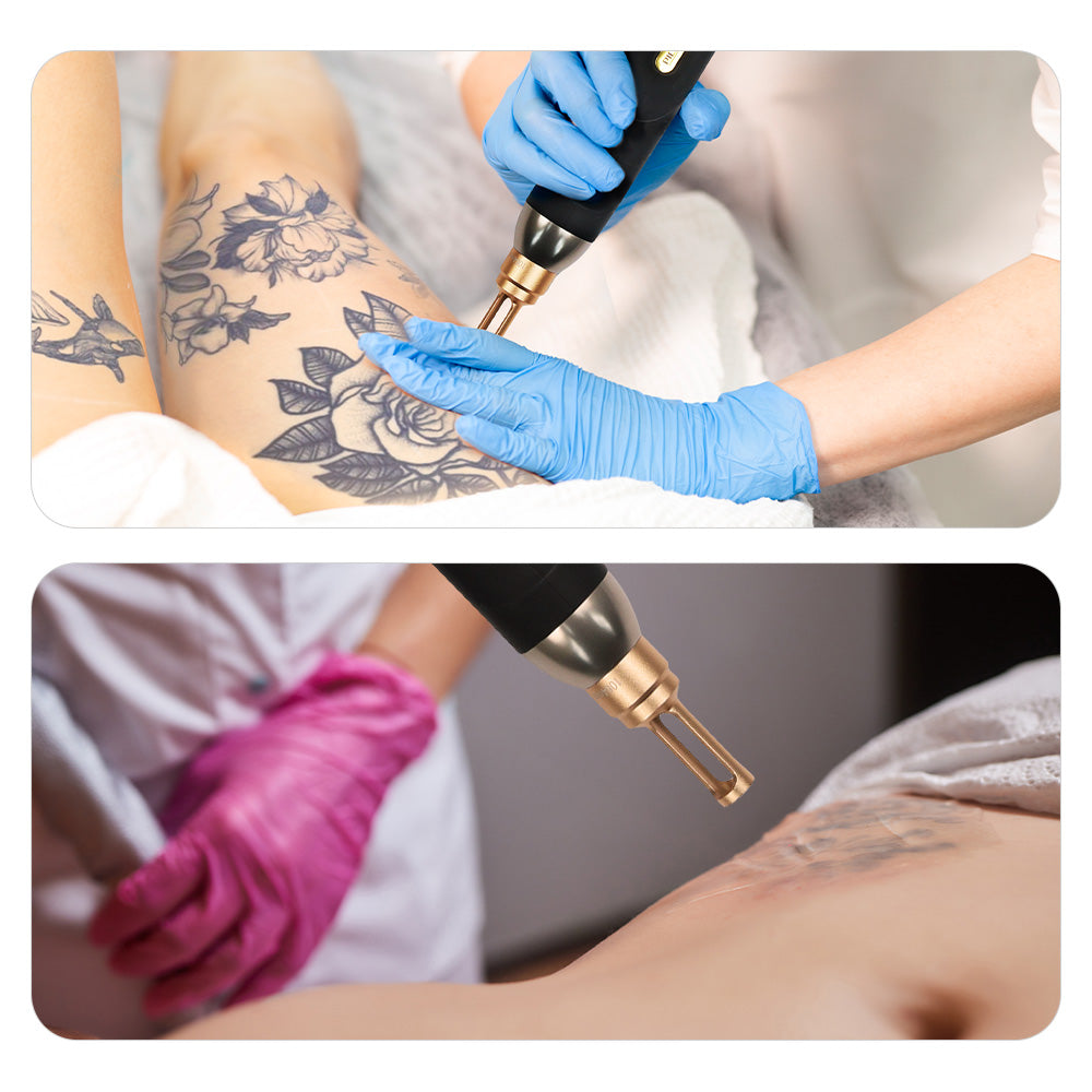 Shape Tactics Pico Laser Carbon Peel System